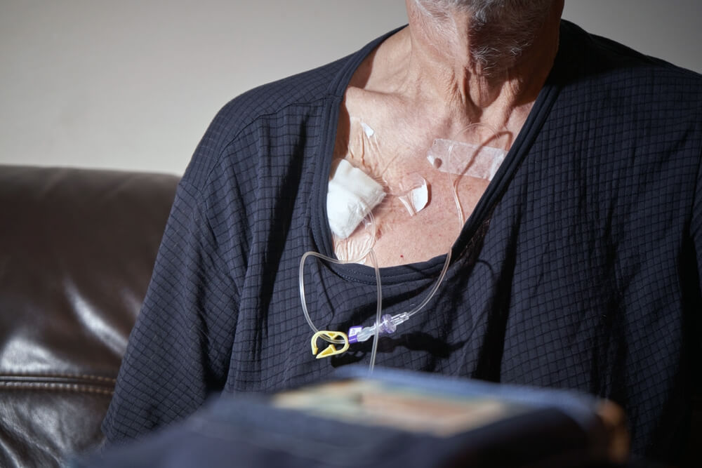 Angiodynamics Port Catheter Lawsuit Over Fractures Blood Clots Infection