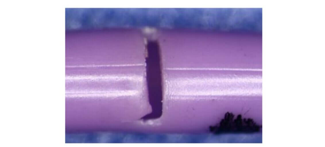 BD PowerPICC Intravascular Catheter Leaks Linked To Reports of Serious Injuries: FDA