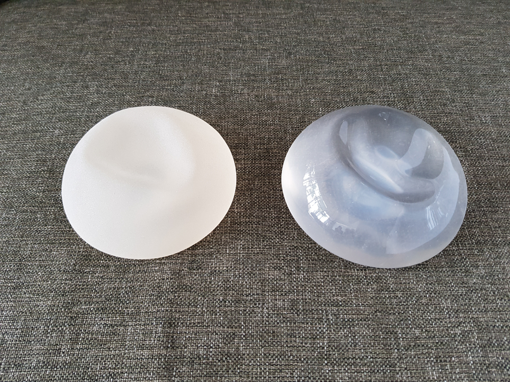 Breast Implant Lymphoma Risk May Extend Beyond ALCL, Researchers Warn