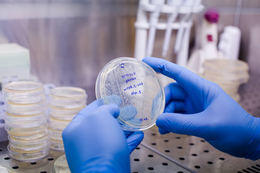 CAR-T-Cell-Therapy-Cancer-Risks-Study
