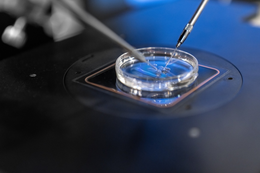 CooperSurgical Embryo Loss Lawsuit Claims Manufacturing Defect Caused Failed IVF Transfer, Emotional Trauma