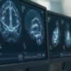 Depo Shot Lawsuit Filed Over Serious Brain Tumor Injuries