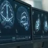 Depo Shot Lawsuit Filed Over Serious Brain Tumor Injuries