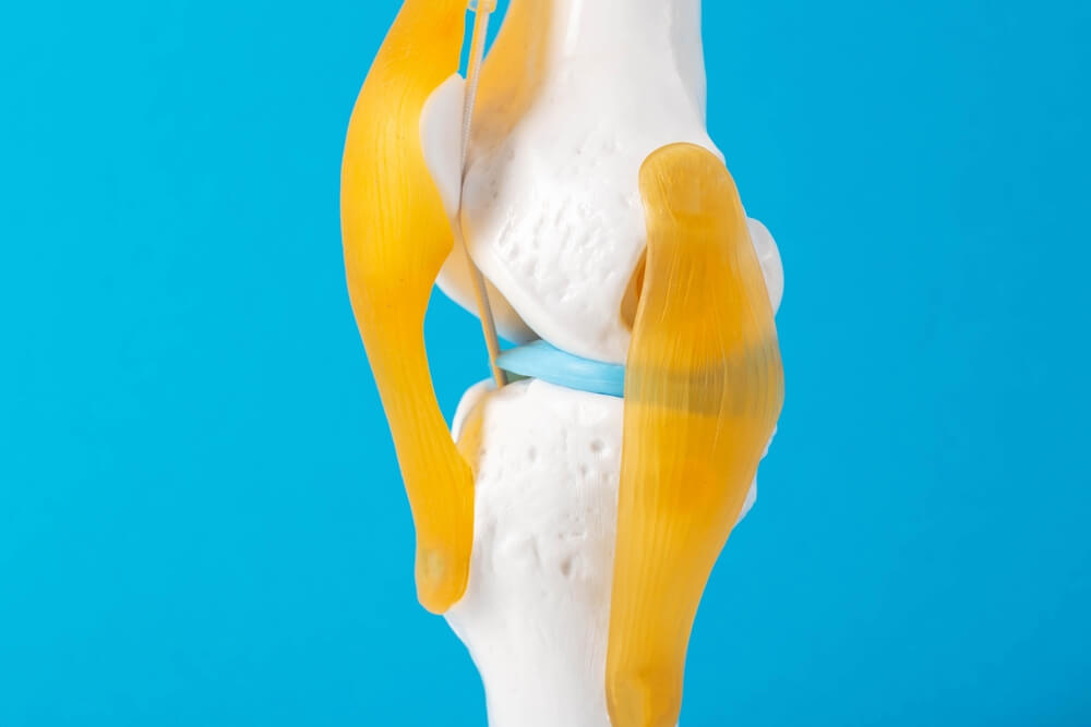 First Exactech Knee Lawsuit Trial Dates in MDL Rescheduled for July 6, 2025 and September 29, 2025