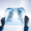 Hundreds of Silicosis Cases Diagnosed Among Quartz Countertop Workers in California Report