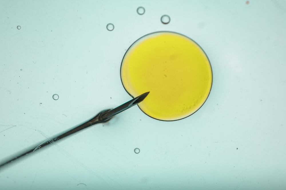 JPML to Consider Consolidation of CooperSurgical IVF Recall Lawsuits Brought Over Failed Fertility Treatments