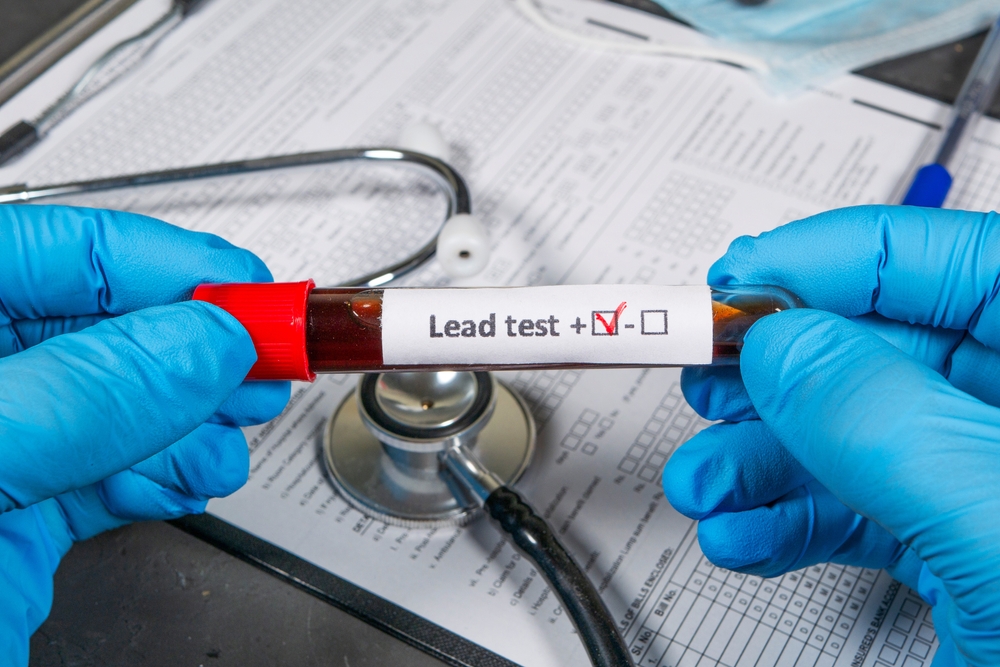 Long-Term Lead Exposure May Increase Risk of Alzheimer's Disease, Dementia Diagnosis Study