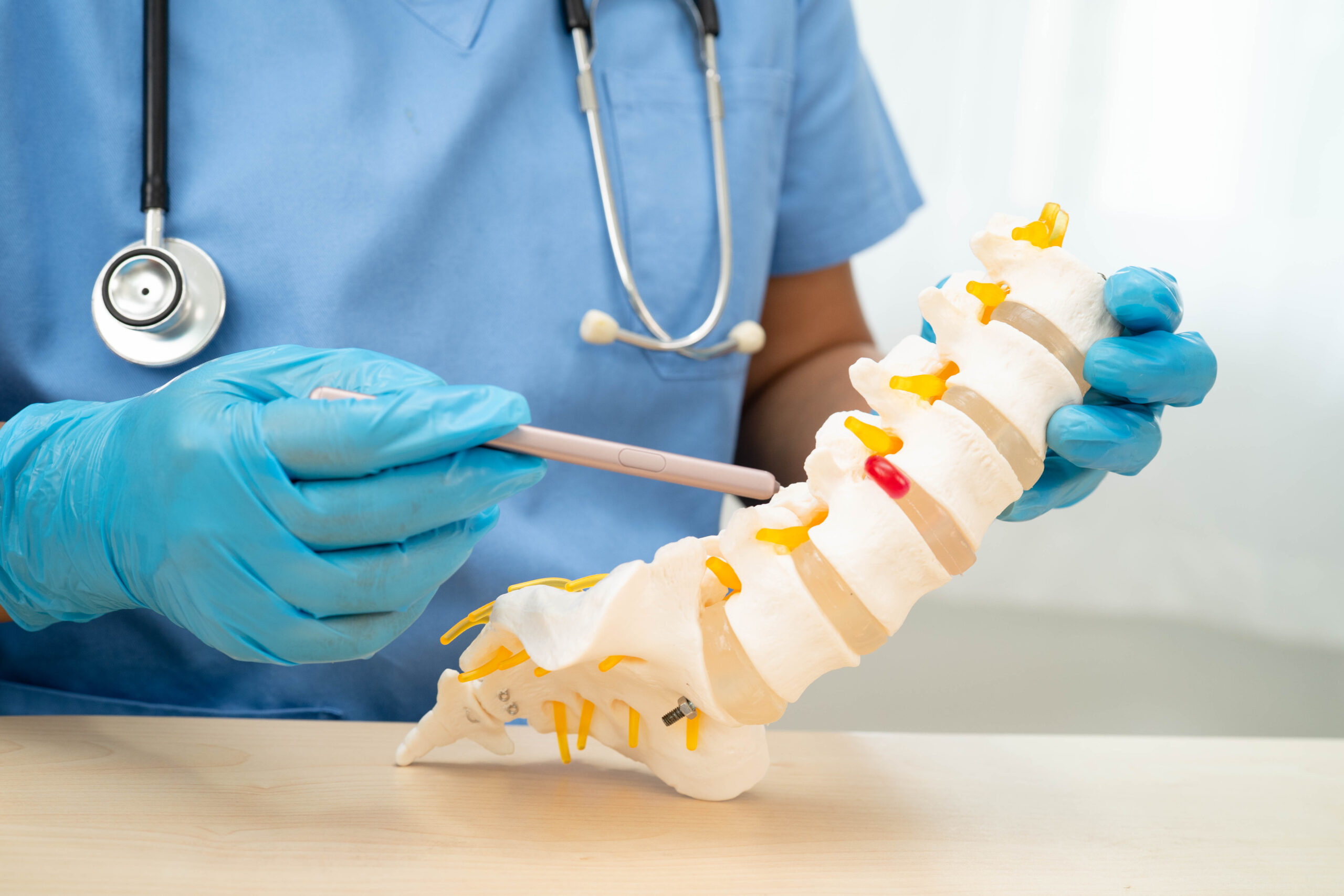 Spinal-Cord-Stimulation-Lawsuit