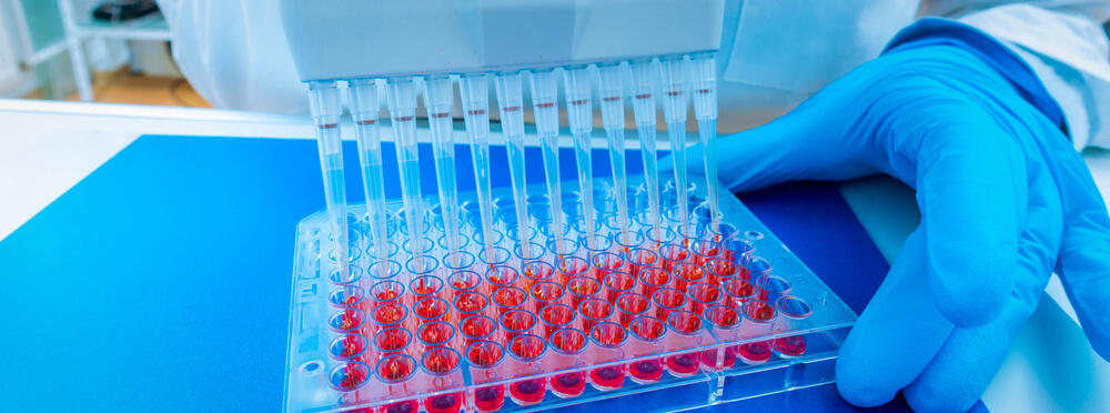 Stem Cell Transplant Skin Cancer Risks