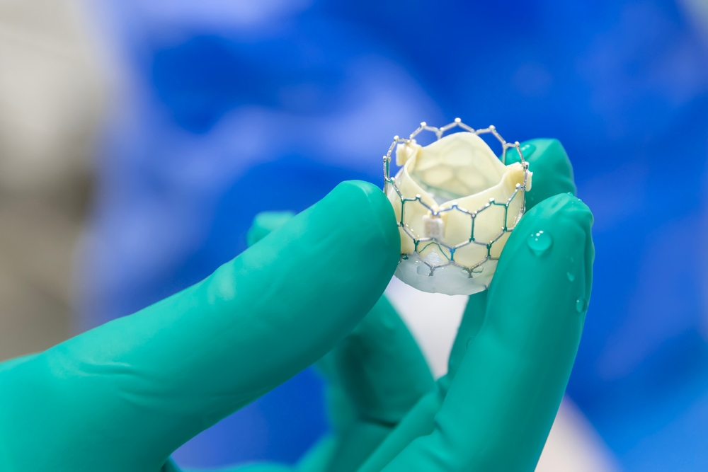 TAVR Approval Linked to Increased Aortic Stenosis Deaths Study