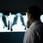 Workers in Mining and Food-Service Industries Face Higher Risks of COPD, CDC Warns