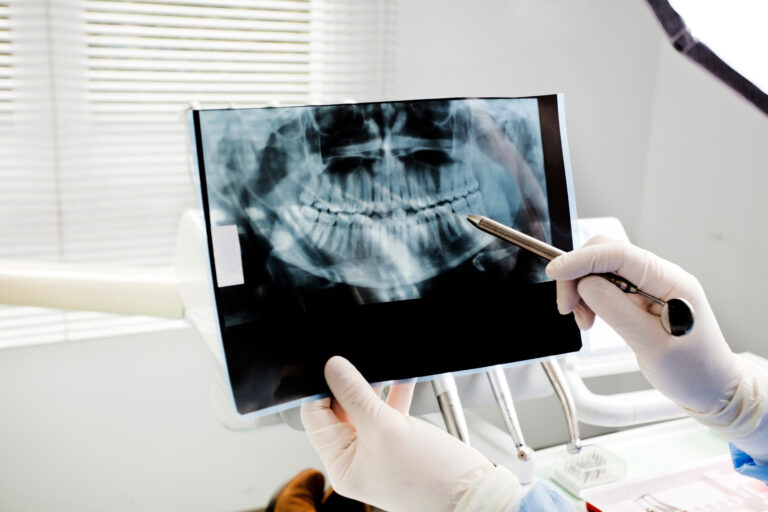 Anterior Growth Guidance Appliance (AGGA) Lawsuits Claim Dental Device Destroyed Teeth, Caused